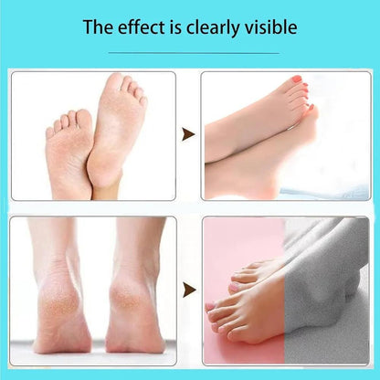 Rechargeable Electric Foot File & Callus Remover – 2 Pack | SBZONE Pakistan | Image 3